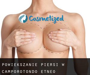 Powiększanie piersi w Camporotondo Etneo