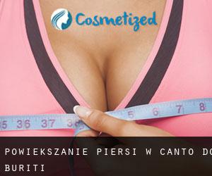 Powiększanie piersi w Canto do Buriti