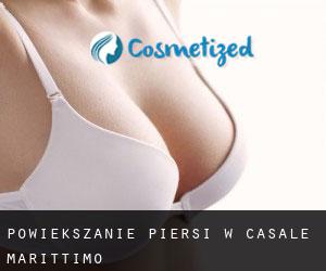 Powiększanie piersi w Casale Marittimo
