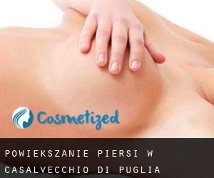 Powiększanie piersi w Casalvecchio di Puglia