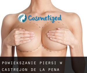 Powiększanie piersi w Castrejón de la Peña