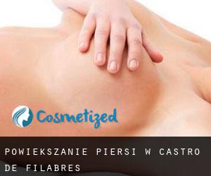 Powiększanie piersi w Castro de Filabres