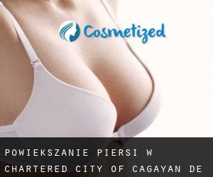 Powiększanie piersi w Chartered City of Cagayan de Oro