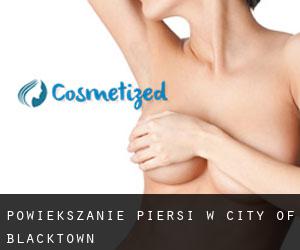 Powiększanie piersi w City of Blacktown