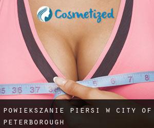 Powiększanie piersi w City of Peterborough