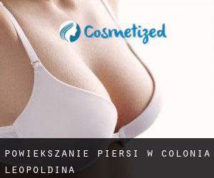Powiększanie piersi w Colônia Leopoldina