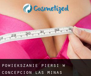 Powiększanie piersi w Concepción Las Minas