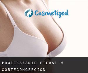 Powiększanie piersi w Corteconcepción