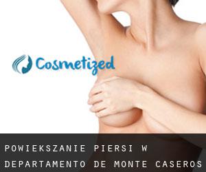 Powiększanie piersi w Departamento de Monte Caseros