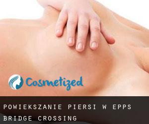 Powiększanie piersi w Epps Bridge Crossing