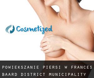 Powiększanie piersi w Frances Baard District Municipality