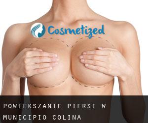 Powiększanie piersi w Municipio Colina