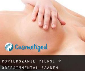 Powiększanie piersi w Obersimmental-Saanen