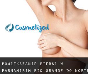 Powiększanie piersi w Parnamirim (Rio Grande do Norte)
