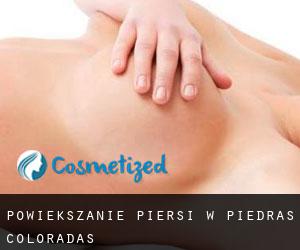 Powiększanie piersi w Piedras Coloradas