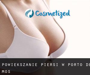 Powiększanie piersi w Porto de Mós