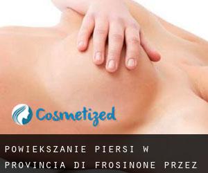 Powiększanie piersi w Provincia di Frosinone przez najbardziej zaludniony obszar - strona 3