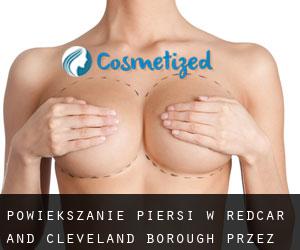 Powiększanie piersi w Redcar and Cleveland (Borough) przez gmina - strona 1