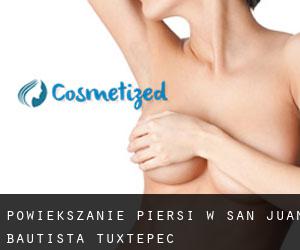 Powiększanie piersi w San Juan Bautista Tuxtepec