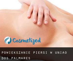 Powiększanie piersi w União dos Palmares