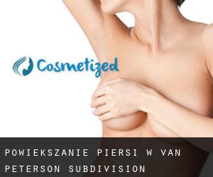 Powiększanie piersi w Van Peterson Subdivision
