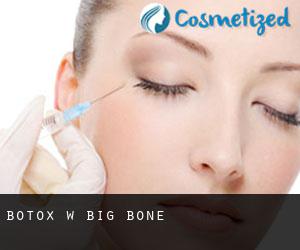 Botox w Big Bone