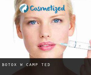 Botox w Camp Ted