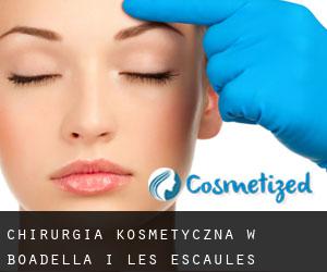 Chirurgia kosmetyczna w Boadella i les Escaules