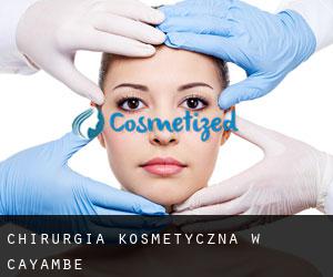 Chirurgia kosmetyczna w Cayambe