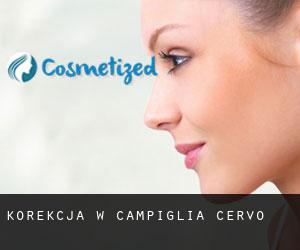 Korekcja w Campiglia Cervo