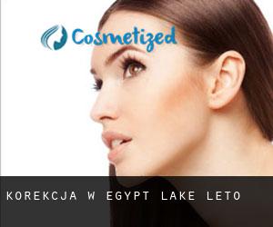 Korekcja w Egypt Lake-Leto
