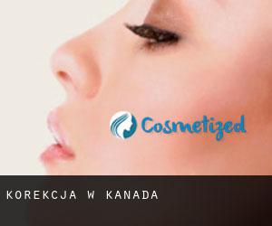 Korekcja w Kanada Korekcja w Kanada