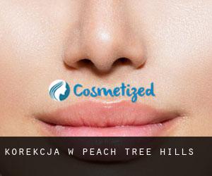 Korekcja w Peach Tree Hills