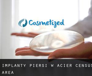 Implanty piersi w Acier (census area)