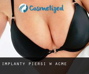 Implanty piersi w Acme