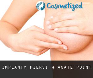 Implanty piersi w Agate Point