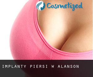 Implanty piersi w Alanson