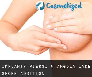 Implanty piersi w Angola Lake Shore Addition