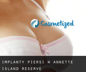 Implanty piersi w Annette Island Reserve