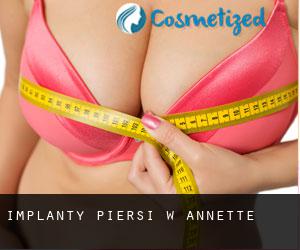 Implanty piersi w Annette