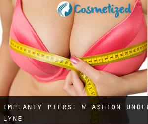 Implanty piersi w Ashton-under-Lyne