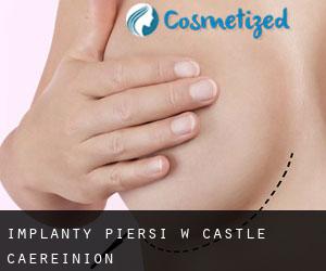 Implanty piersi w Castle Caereinion
