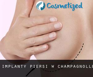 Implanty piersi w Champagnolle