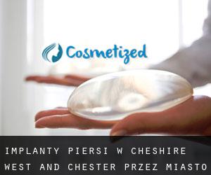 Implanty piersi w Cheshire West and Chester przez miasto - strona 1