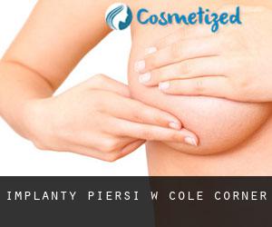 Implanty piersi w Cole Corner