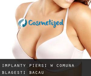 Implanty piersi w Comuna Blăgeşti (Bacău)