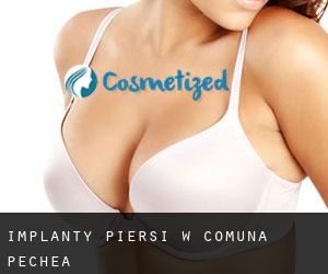Implanty piersi w Comuna Pechea
