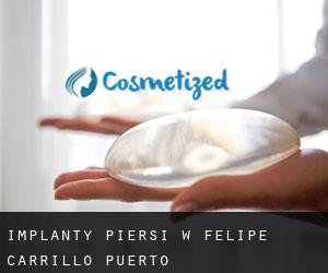 Implanty piersi w Felipe Carrillo Puerto
