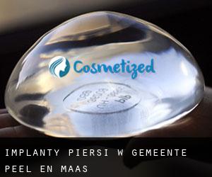 Implanty piersi w Gemeente Peel en Maas