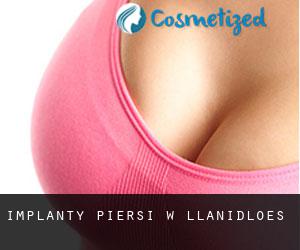 Implanty piersi w Llanidloes